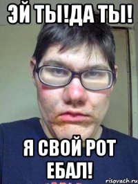 эй ты!да ты! я свой рот ебал!