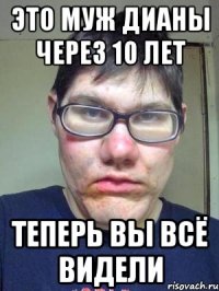 это муж дианы через 10 лет теперь вы всё видели