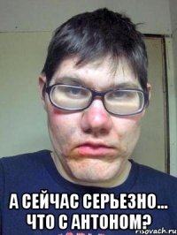  А сейчас серьезно... Что с Антоном?