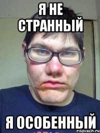 Я не странный я особенный