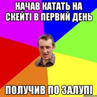 Начав катать на скейті в первий день Получив по залупі