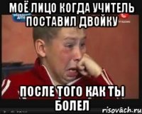 моё лицо когда учитель поставил двойку после того как ты болел