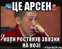 Це арсен коли ростянув звязки на нозі