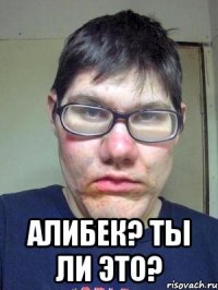  Алибек? Ты ли это?