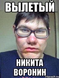 ВЫЛЕТЫЙ НИКИТА ВОРОНИН