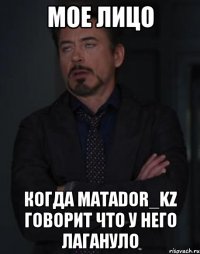 Мое лицо когда MATADOR_KZ говорит что у него лагануло