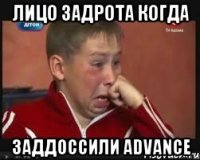 Лицо задрота когда ЗаДДоссили Advance