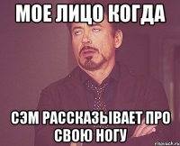 МОЕ ЛИЦО КОГДА СЭМ РАССКАЗЫВАЕТ ПРО СВОЮ НОГУ