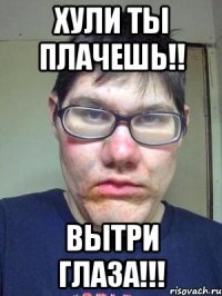 Хули ты плачешь!! Вытри глаза!!!