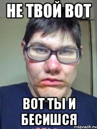 Не твой вот Вот ты и бесишся