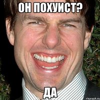 он похуист? да