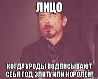 Лицо когда уроды подписывают себя под элиту или королей!