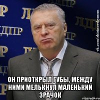  Он приоткрыл губы, между ними мелькнул маленький зрачок