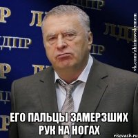  его пальцы замерзших рук на ногах