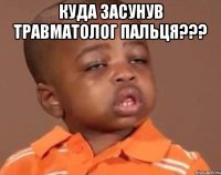 куда засунув травматолог пальця??? 