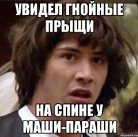 Увидел гнойные прыщи на спине у Маши-Параши