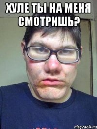 Хуле ты на меня смотришь? 