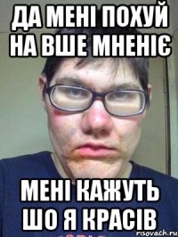 Да мені похуй на вше мненіє Мені кажуть шо я красів