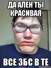 Да Ален ты красивая Все збс в те