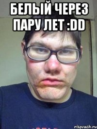 Белый через Пару лет :DD 