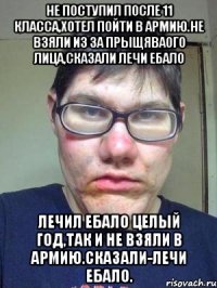 Не поступил после 11 класса,хотел пойти в армию.Не взяли из за прыщяваого лица,сказали лечи ебало Лечил ебало целый год,так и не взяли в армию.Сказали-лечи ебало.