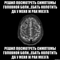 Решил посмотреть симптомы головной боли...Ебать колотить да у меня ж рак мозга Решил посмотреть симптомы головной боли...Ебать колотить да у меня ж рак мозга