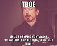 твое лицо в обычной ситуации *показывает на тебя!да да именно тебя!*