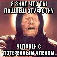 Я знал что ты пошлеш эту фотку Человек с потеренным членом