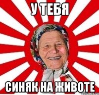 у тебя синяк на животе