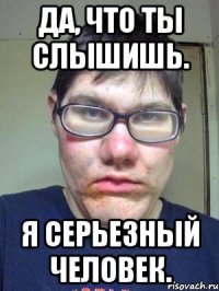 Да, что ты слышишь. Я Серьезный человек.