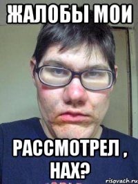 жалобы мои рассмотрел , нах?