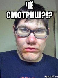 Чё СМОТРИШ?!? 