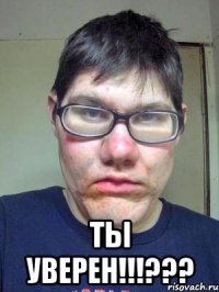  ТЫ УВЕРЕН!!!???