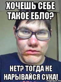 Хочешь себе такое ебло? Нет? Тогда не нарывайся сука!