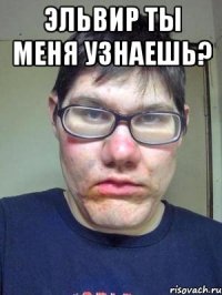 Эльвир ты меня узнаешь? 