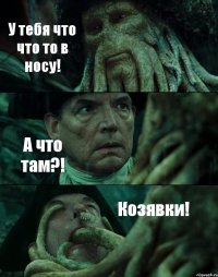 У тебя что что то в носу! А что там?! Козявки!