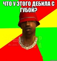 что у этого дебила с губой? 