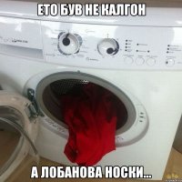 ЕТО БУВ НЕ КАЛГОН А ЛОБАНОВА НОСКИ...