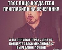 твое лицо,когда тебя пригласили на вечеринку а ты очнулся через 2 дня на концерте стаса михайлова с вырезаной почкой
