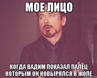 Мое лицо Когда Вадим показал палец которым он ковырялся в жопе