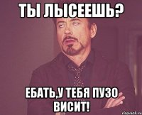 Ты лысеешь? Ебать,у тебя пузо висит!