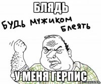 блядь у меня герпис