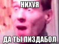 НИХУЯ да ты пиздабол