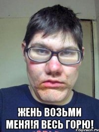  Жень возьми меня!я весь горю!