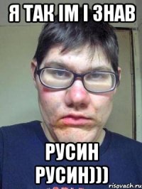 Я так ім і знав русин русин)))