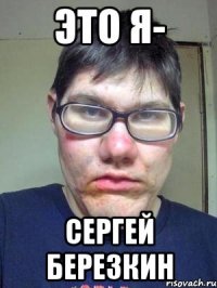 Это я- Сергей Березкин