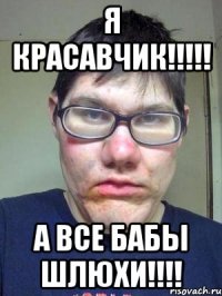 Я КРАСАВЧИК!!!!! А ВСЕ БАБЫ ШЛЮХИ!!!!