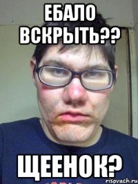 ебало вскрыть?? щеенок?