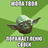 ЖОПА ТВОЯ ПОРАЖАЕТ ЛЕНЮ СВОЕЙ