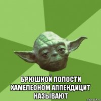  Брюшной полости хамелеоном аппендицит называют